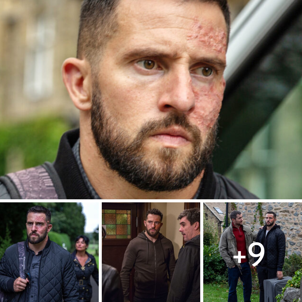 Emmerdale confirms Mike Parr return as Ross Barton in new social media post